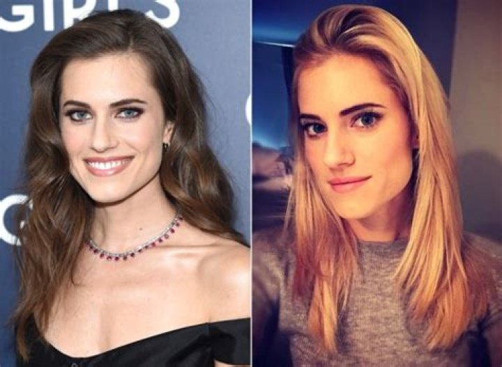 Did Allison Williams Get Her Nose Done? Plastic Surgery Before And After