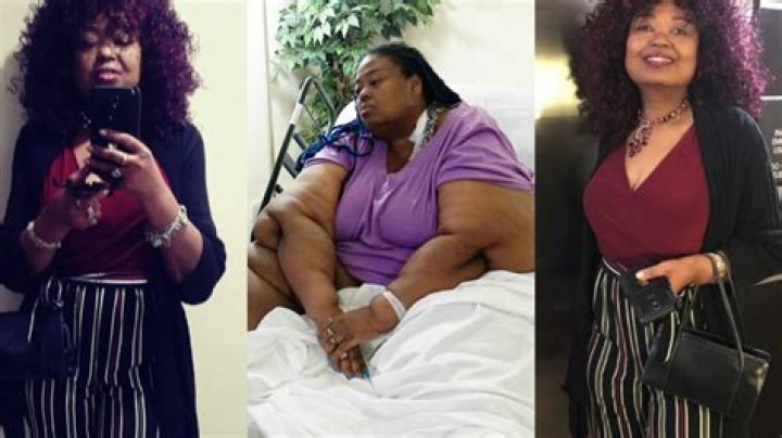 Did Marla My 600-lb Life Died? Marla McCants Still Alive Now? Surgery Update