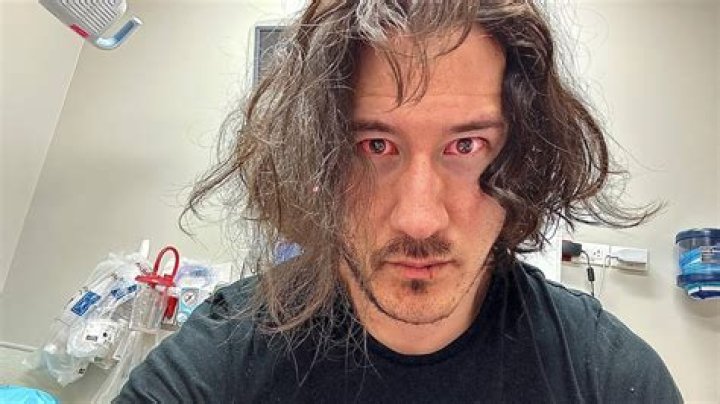Is Markiplier Dead or Alive? What Has Happened To Markiplier Suffering? Cause Of Death