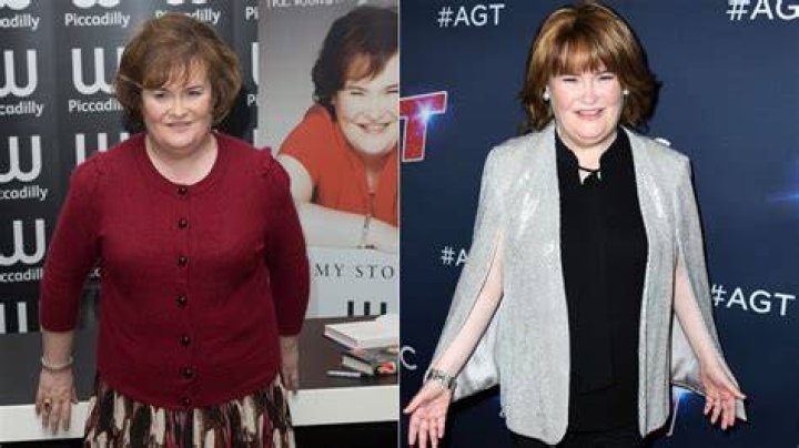 
Is Susan Boyle Autism? Health Issues And Weight Loss 