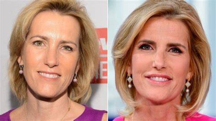 Laura Ingraham Lips: Did Laura Ingraham Get Her Lips Done? Plastic Surgery Before And After Photos