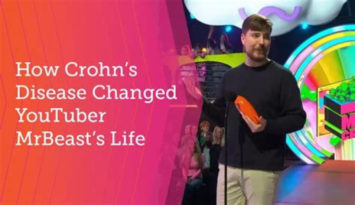Mr Beast Crohn Disease Led To Death Hoax, Your Favorite YouTuber Is Alive and Well