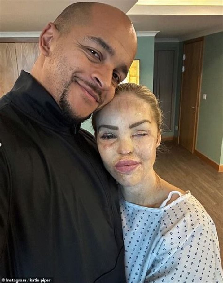 
The Truth About Katie Piper, Her Husband and What Led to Her Acid Attack 