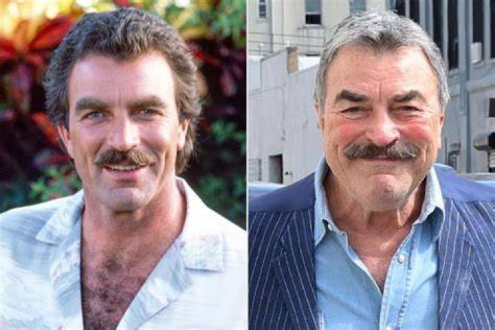 
What Disease Does Tom Selleck Have – Is He Still Alive Or Passed Away? 
