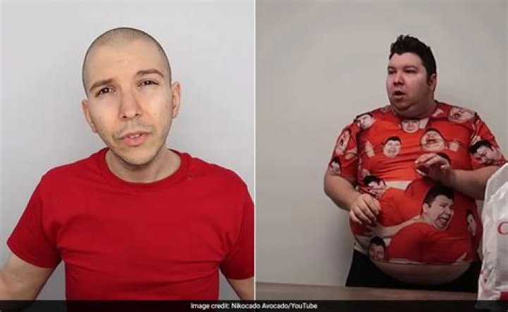 
What Happened To Nikocado Avocado? His Broken Ribs Issue 