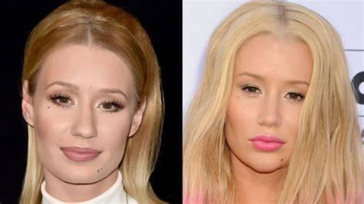 
Why Iggy Azalea Quits Music? Is Iggy Azalea Albino? 